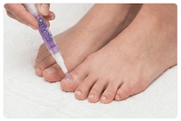 Orivelle Fungus Pen how to use